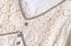 White Lace Dress